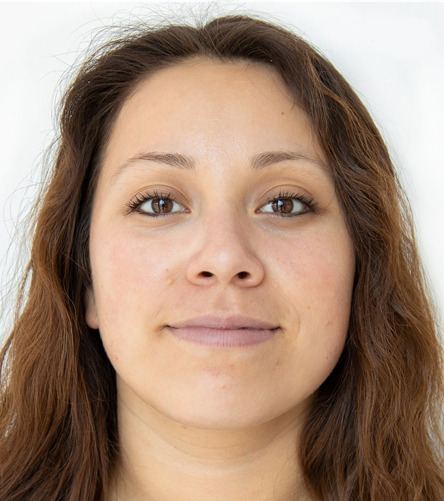 After treatment result two