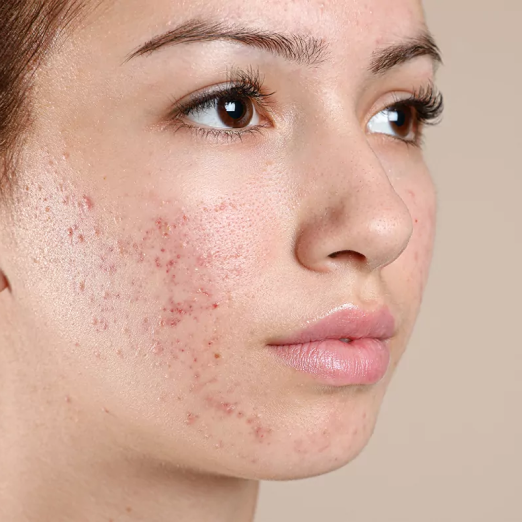 Before treatment result one